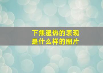 下焦湿热的表现是什么样的图片