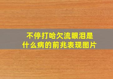 不停打哈欠流眼泪是什么病的前兆表现图片