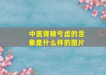 中医肾精亏虚的舌象是什么样的图片