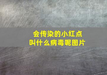 会传染的小红点叫什么病毒呢图片