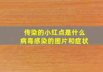 传染的小红点是什么病毒感染的图片和症状