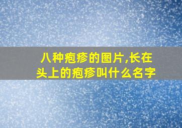 八种疱疹的图片,长在头上的疱疹叫什么名字