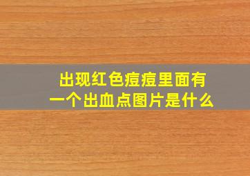 出现红色痘痘里面有一个出血点图片是什么