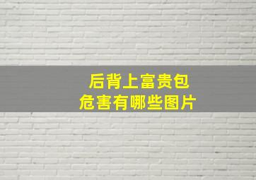 后背上富贵包危害有哪些图片