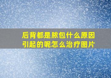 后背都是脓包什么原因引起的呢怎么治疗图片