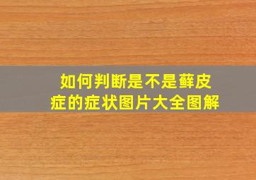 如何判断是不是藓皮症的症状图片大全图解