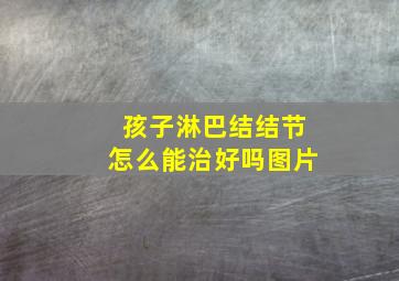 孩子淋巴结结节怎么能治好吗图片