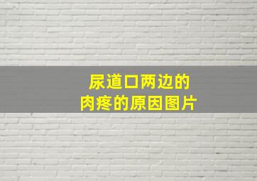 尿道口两边的肉疼的原因图片