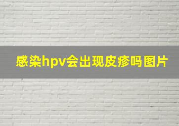 感染hpv会出现皮疹吗图片