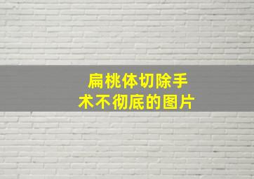 扁桃体切除手术不彻底的图片