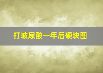 打玻尿酸一年后硬块图