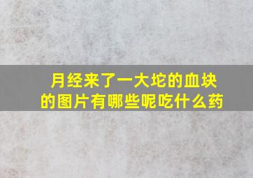 月经来了一大坨的血块的图片有哪些呢吃什么药