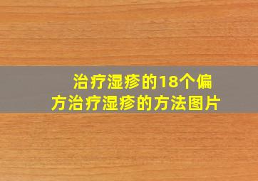 治疗湿疹的18个偏方治疗湿疹的方法图片