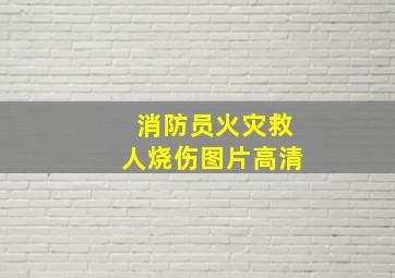 消防员火灾救人烧伤图片高清