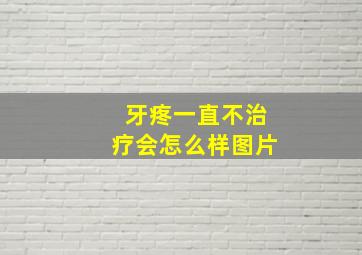 牙疼一直不治疗会怎么样图片