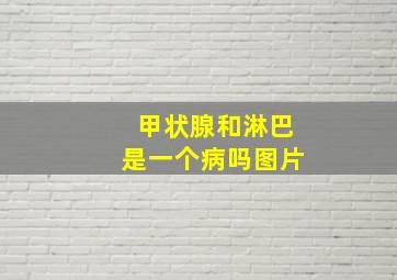 甲状腺和淋巴是一个病吗图片