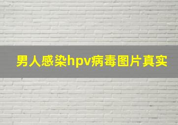 男人感染hpv病毒图片真实