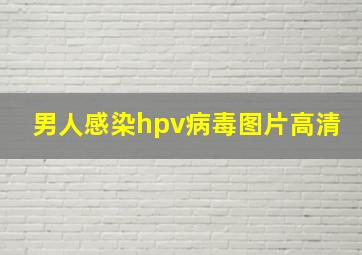 男人感染hpv病毒图片高清