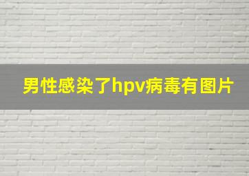 男性感染了hpv病毒有图片