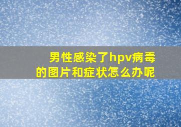 男性感染了hpv病毒的图片和症状怎么办呢