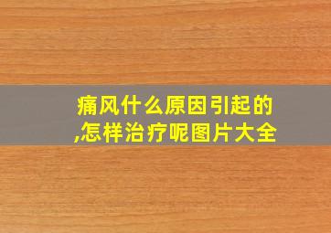 痛风什么原因引起的,怎样治疗呢图片大全