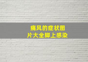 痛风的症状图片大全脚上感染