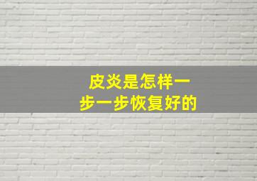 皮炎是怎样一步一步恢复好的