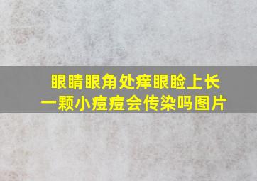 眼睛眼角处痒眼睑上长一颗小痘痘会传染吗图片