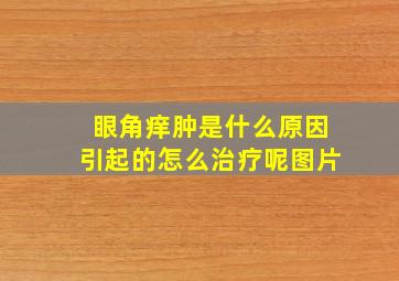 眼角痒肿是什么原因引起的怎么治疗呢图片