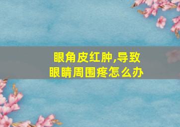 眼角皮红肿,导致眼睛周围疼怎么办