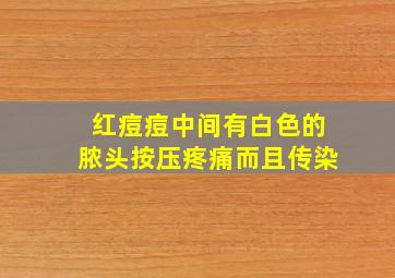 红痘痘中间有白色的脓头按压疼痛而且传染