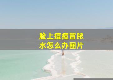 脸上痘痘冒脓水怎么办图片