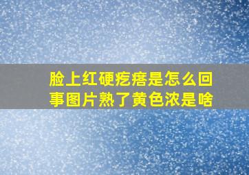 脸上红硬疙瘩是怎么回事图片熟了黄色浓是啥