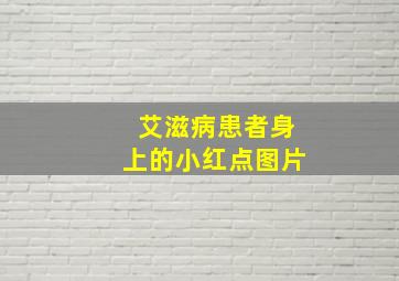 艾滋病患者身上的小红点图片