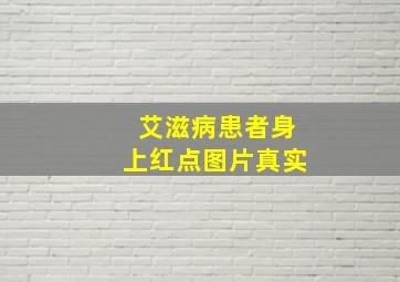 艾滋病患者身上红点图片真实