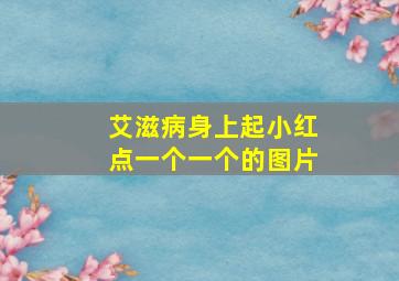 艾滋病身上起小红点一个一个的图片