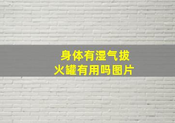 身体有湿气拔火罐有用吗图片