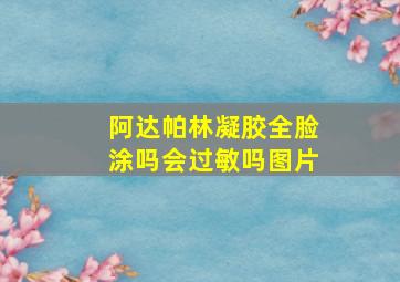 阿达帕林凝胶全脸涂吗会过敏吗图片