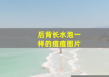 后背长水泡一样的痘痘图片