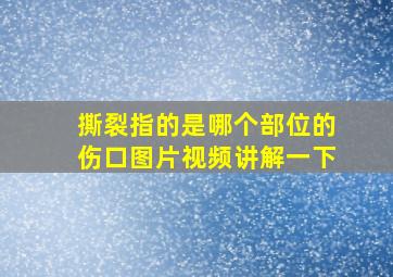 撕裂指的是哪个部位的伤口图片视频讲解一下