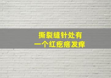 撕裂缝针处有一个红疙瘩发痒