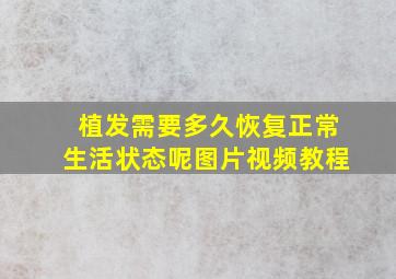 植发需要多久恢复正常生活状态呢图片视频教程