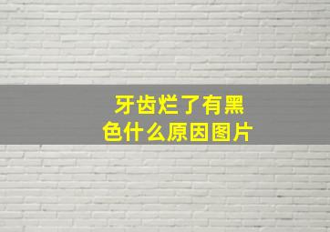 牙齿烂了有黑色什么原因图片