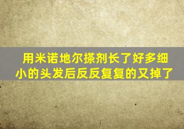 用米诺地尔搽剂长了好多细小的头发后反反复复的又掉了