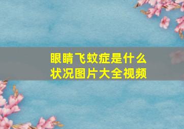 眼睛飞蚊症是什么状况图片大全视频